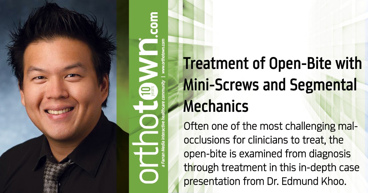 Treatment of Open-Bite with Mini-Screws and Segmental Mechanics Often one of the most challenging malocclusions for clinicians to treat, the open-bite is examined from diagnosis through treatment in this in-depth case presentation from Dr. Edmund Khoo.