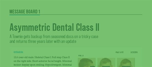 Asymmetric Dental Class II A Townie gets backup from seasoned docs on a tricky case.
