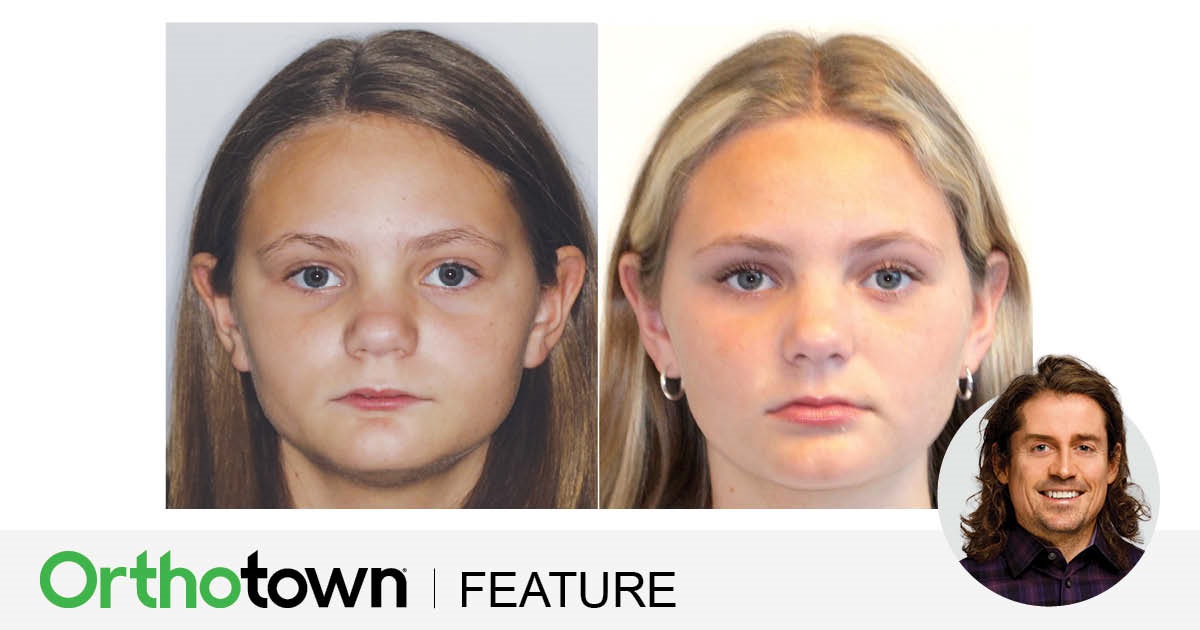 ‘Short-Face’ Patients—Part 3