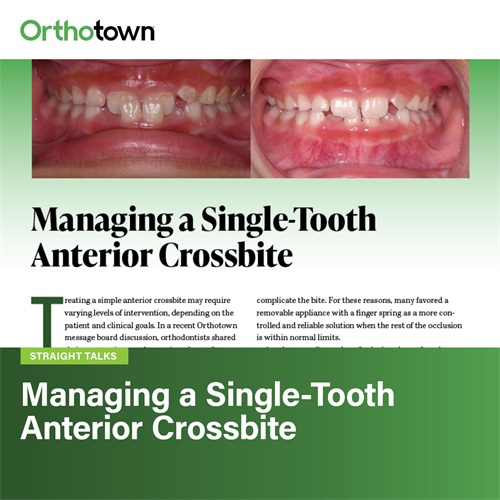Managing a Simple Anterior Crossbite Orthodontists weigh tongue blades, bite ramps and appliances for single-tooth anterior crossbites, debating compliance, predictability and when simple fixes still make sense.