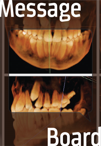 Challenging Skeletal Class 2 Case with Impacted U3s A Townie wonders if his patient should be an extraction case.