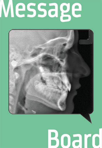 Severe Crowding Is it possible to treat a severe crowding case as a nonextraction case?