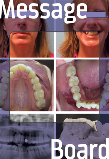 Punt This Perio One member asks his fellow Townies:  At what point can orthodontists no longer be of service?