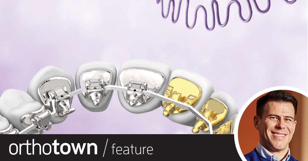 So, You Think You Can Handle Lingual Ortho? Dr. Matthew Schofield, a proponent of lingual orthodontics, discusses major business and practical considerations, runs through the main product options available in the United States, and shares case reports with tips and advice.