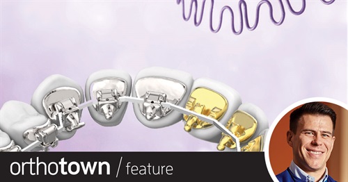 So, You Think You Can Handle Lingual Ortho? Dr. Matthew Schofield, a proponent of lingual orthodontics, discusses major business and practical considerations, runs through the main product options available in the United States, and shares case reports with tips and advice.