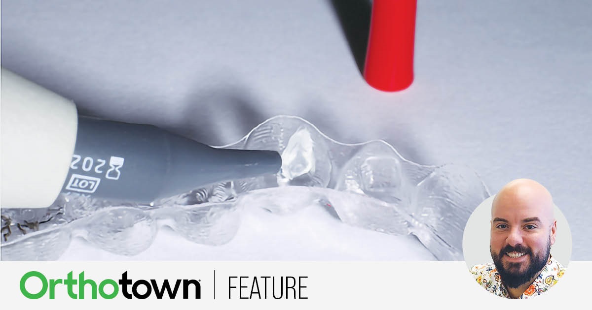 Bonding Rituals Paul Gange Jr. shares a collection of tips to ease the learning curve of the indirect bonding process, including information about the etching, primer/adhesive interface, tray delivery and removal, irritation relief and more.