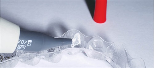 Bonding Rituals Paul Gange Jr. shares a collection of tips to ease the learning curve of the indirect bonding process, including information about the etching, primer/adhesive interface, tray delivery and removal, irritation relief and more.