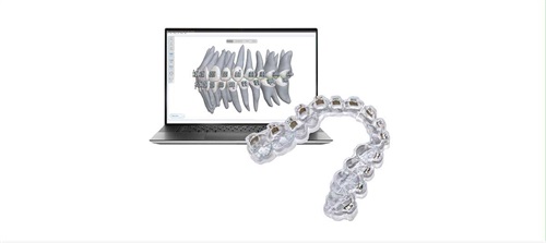 Earned Placement: Advances in Orthodontics A conversation about digital and custom bracket bonding