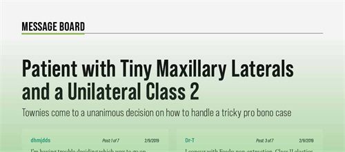 Patient with Tiny Maxillary Laterals and a Unilateral Class 2 Townies come to a unanimous decision on how to handle a tricky pro bono case