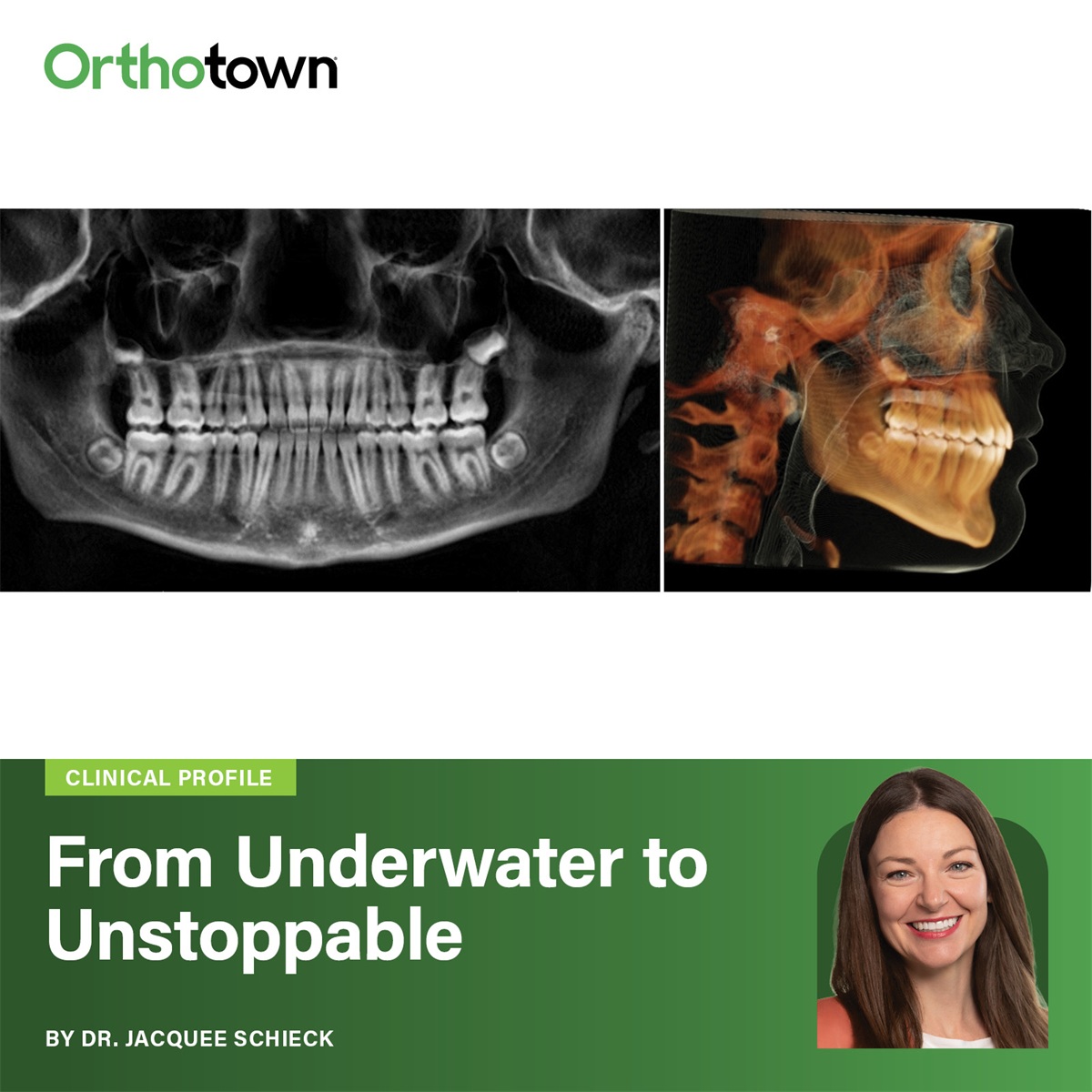 From Underwater to Unstoppable