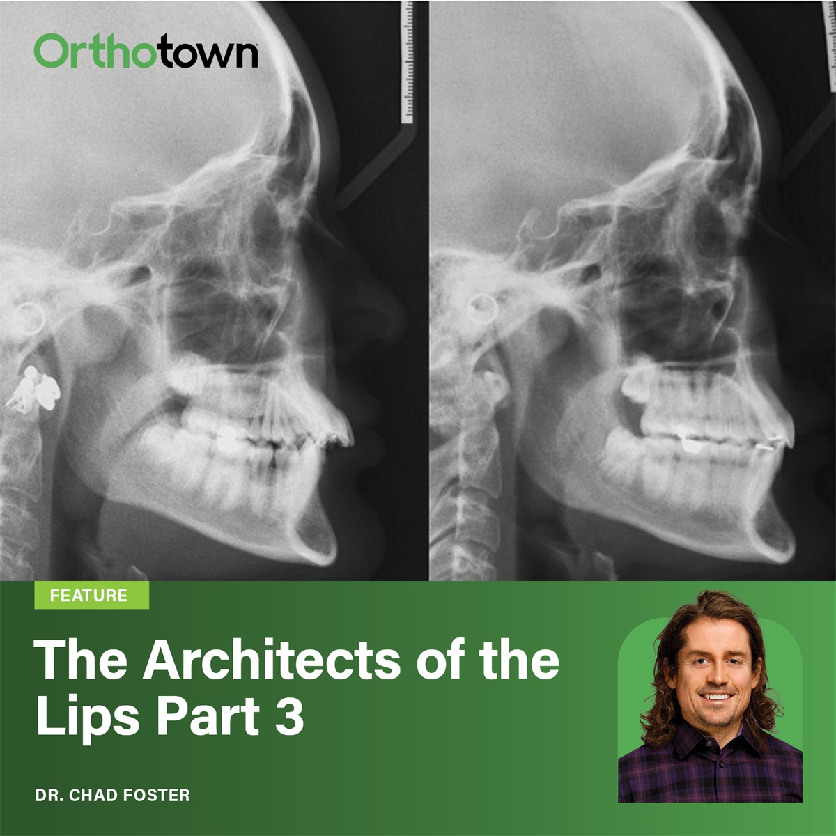 The Architects of the Lips: Part 3