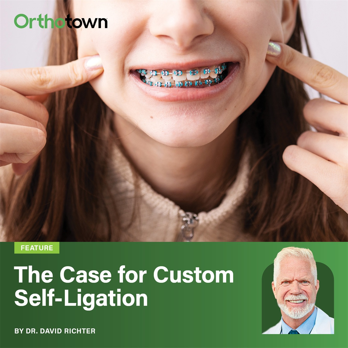 The Case for Custom Self-Ligation