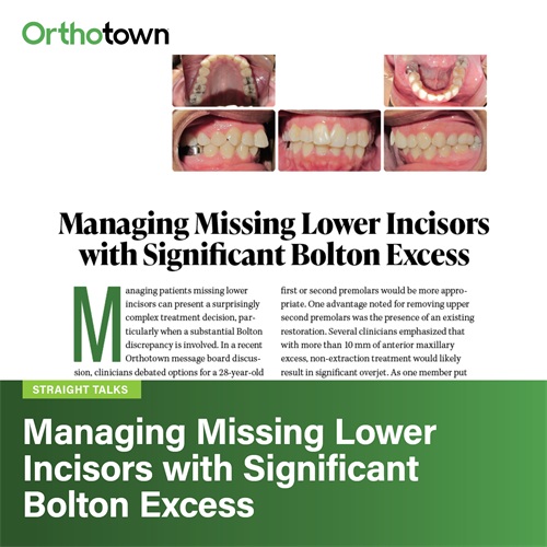 Managing Missing Lower Incisors with Significant Bolton Excess 
