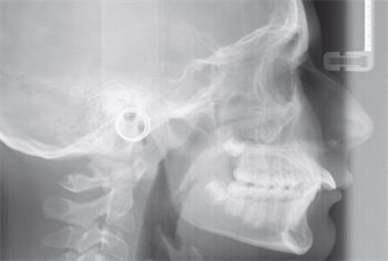 Practice Solutions: American Orthodontics Take a look at American Orthodontics