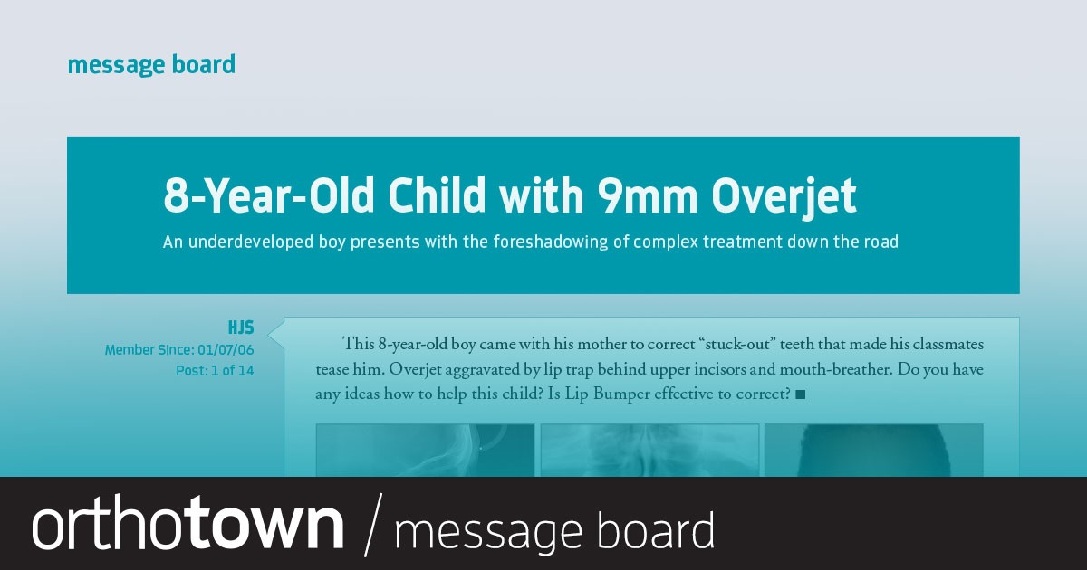 8-Year-Old Child with 9mm Overjet An underdeveloped boy presents with the foreshadowing of complex treatment down the road.