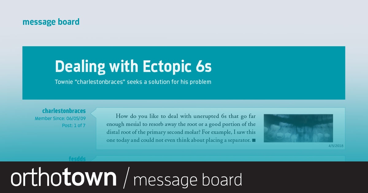 Dealing with Ectopic 6s Townie “charlestonbraces” seeks a solution for his problem.