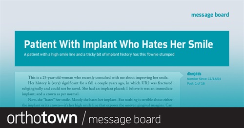 Patient With Implant Who Hates Her Smile A patient with a high smile line and a tricky bit of implant history has this Townie stumped.