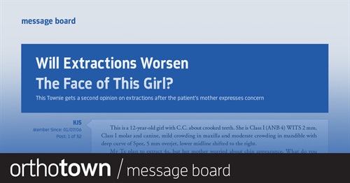Will Extractions Worsen the Face of This Girl? This Townie gets a second opinion on extractions after the patient’s mother expresses concern.