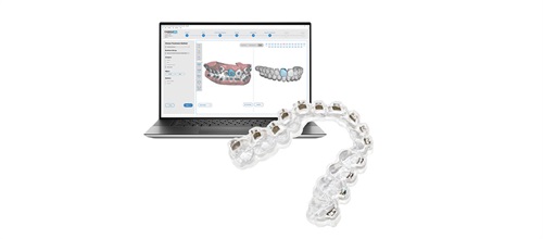 Earned Placement: Indirect Bonding - Real-World Experiences Orthodontists Discuss How Using Dibs AI By Orthoselect Has Made Their Practices More Efficient And Effective