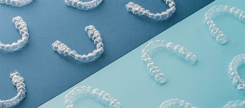 Is It Time for a Realignment? As Dr. Kevin Baharvand explains, changing aligner companies isn’t just about switching products—it’s a transition that affects patients, staff and the overall rhythm of an orthodontic practice. Drawing from his own experiences, Baharvand shares a down-to-earth guide on how to make the transition a smoother one.