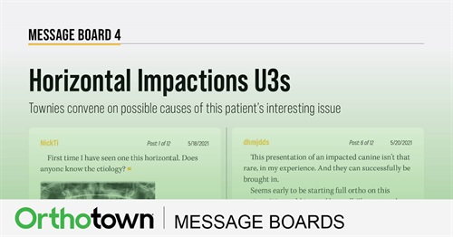 Horizontal Impactions U3s Townies convene on possible causes of this patient’s interesting issue