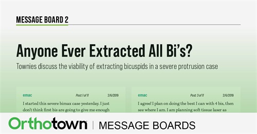 Anyone Ever Extracted All Bi’s? Townies discuss the
viability of extracting all
bicuspids in a severe
bimaxillary protrusion
case.
