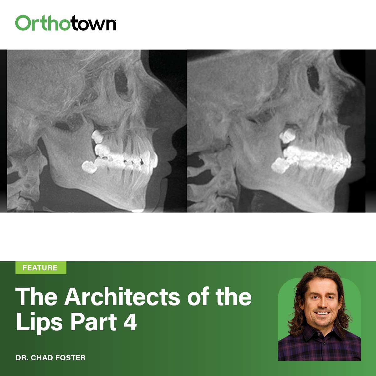 The Architects of the Lips: Part 4