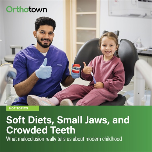 Soft Diets, Small Jaws, and Crowded Teeth Modern soft diets and reduced chewing in childhood may be a key environmental driver of malocclusion, shifting it from a genetic inevitability to a preventable developmental issue.