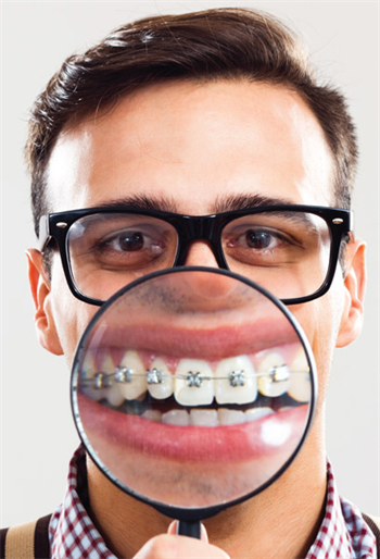 White Spot Lesions: A Hygiene Perspective in the Orthodontic Practice Hygienist Miranda Valenzuela discusses prevention and remineralization of white spot lesions for orthodontic patients.
