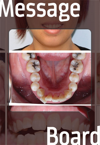 How Would You Treat This Case? A Townie asks for feedback about how to proceed—extractions? uprighting?— and shows his results.