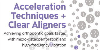 Acceleration Techniques  for Clear Aligner Patients Dr. Payam Ataii discusses how acceleration techniques such as manual osteoperforation and high-frequency vibration can help speed orthodontic treatment of patients, even if they insist on using only clear aligners during treatment.