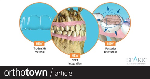 Product Profile: Ormco Spark Clear Aligners Release 10