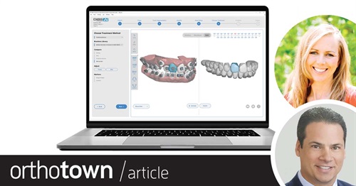 Earned Placement: OrthoSelect Dibs AI Two practitioners discuss how indirect bonding with Dibs AI has made practice more predictable and profitable