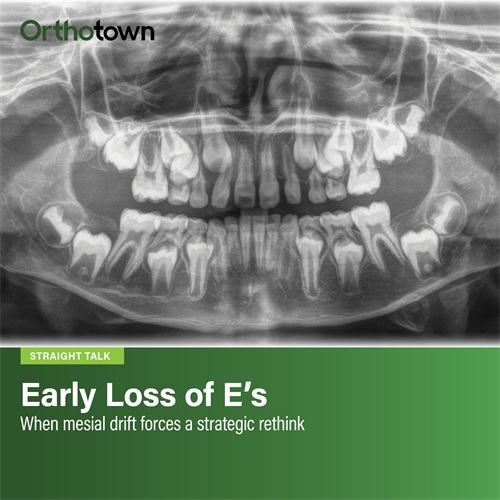 Early Loss of E's When mesial drift forces a strategic rethink