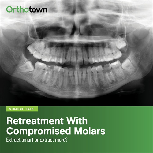 Retreatment With Compromised Molars Extract smart or extract more?