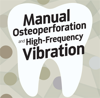 Manual Osteoperforation and High-Frequency Vibration Dr. Bruce McFarlane shares four cases that used a combination of manual osteoperforation to treat stubborn cases and high-frequency vibration to help with aligner seating.