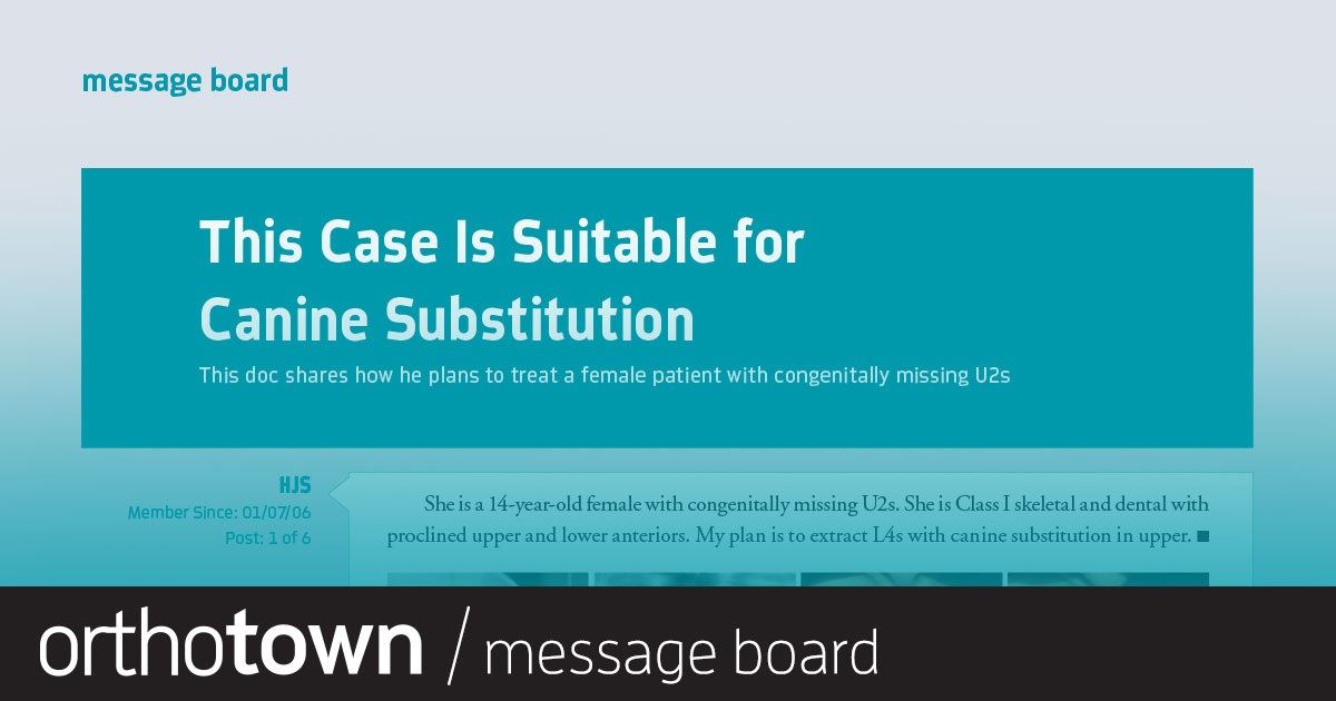 This Case Is Suitable  for Canine Substitution This doc shares how he plans to treat a female patient with congenitally missing U2s.