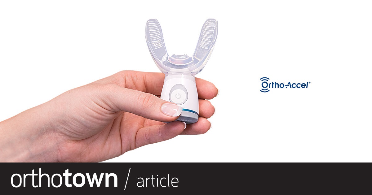 Product Profile: AcceleDent Optima Building a better orthodontic experience