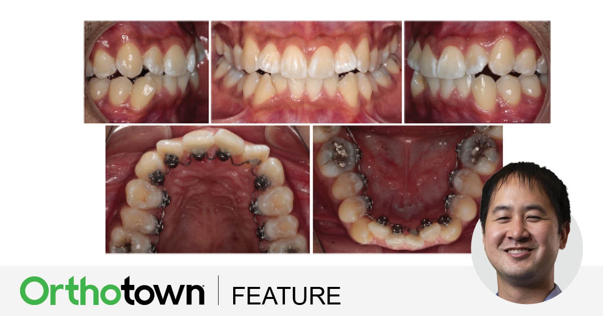 Townie Treatment Case: Sight Unseen