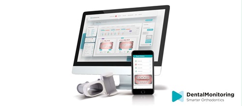 Product Profile: DentalMonitoring Convenience for patients, clinical control for doctors