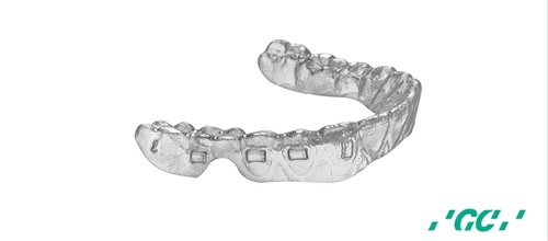 Product Profile: MOV’Aligners Healthier smiles for every patient