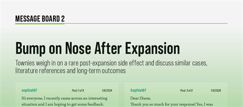 Bump on Nose After Expansion Townies weigh in on a rare post-expansion side effect and discuss similar cases, literature references and long-term outcomes