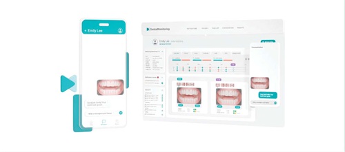 Game Changers: The First Step in Adopting Remote Monitoring Dr. Roger P. Levin outlines how orthodontic practices can boost efficiency and revenue by implementing a remote monitoring manager and supporting systems.