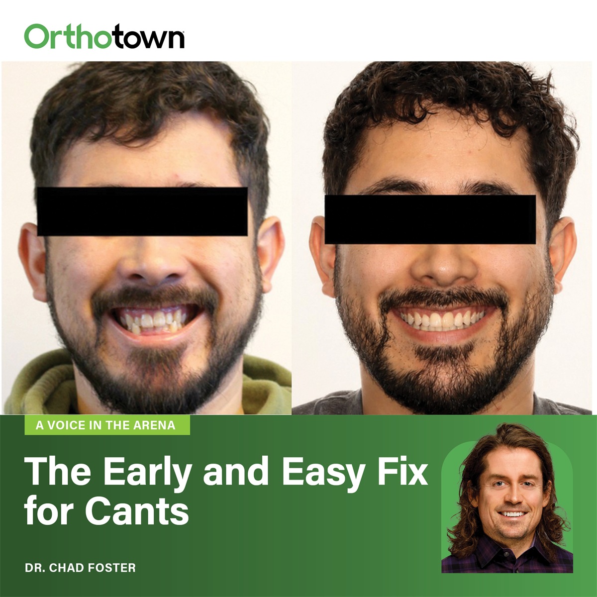 A Voice in the Arena: The Early and Easy Fix for Cants