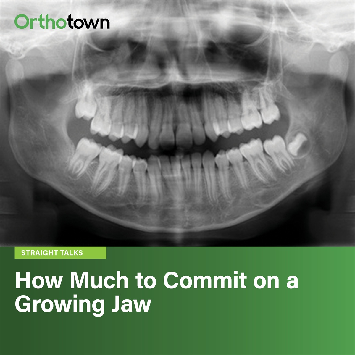 How Much to Commit on a Growing Jaw