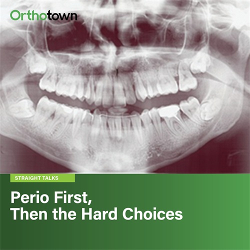 Perio First, Then the Hard Choices A periodontally compromised adult retreatment forces clinicians to weigh disease control, extraction choices, space closure, and whether to treat at all.