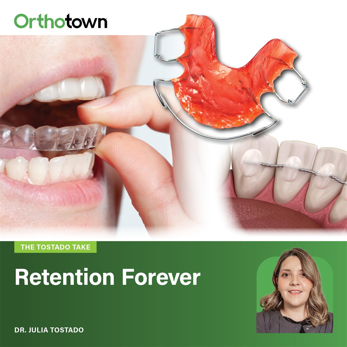 The Tostado Take: Retention Forever