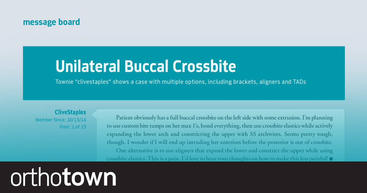 Unilateral Buccal Crossbite Townie “clivestaples” shows a case with multiple options, including brackets,  aligners and TADs.