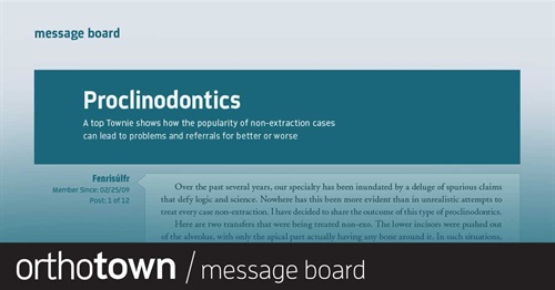 Proclinodontics This Townie shares the downside of treating every case as a non-extraction case.