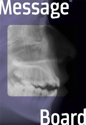 Non-Sx. Plan for This Case? The mother of a Class III patient with speech issues wants to avoid surgery. Can this ortho treat her without it?